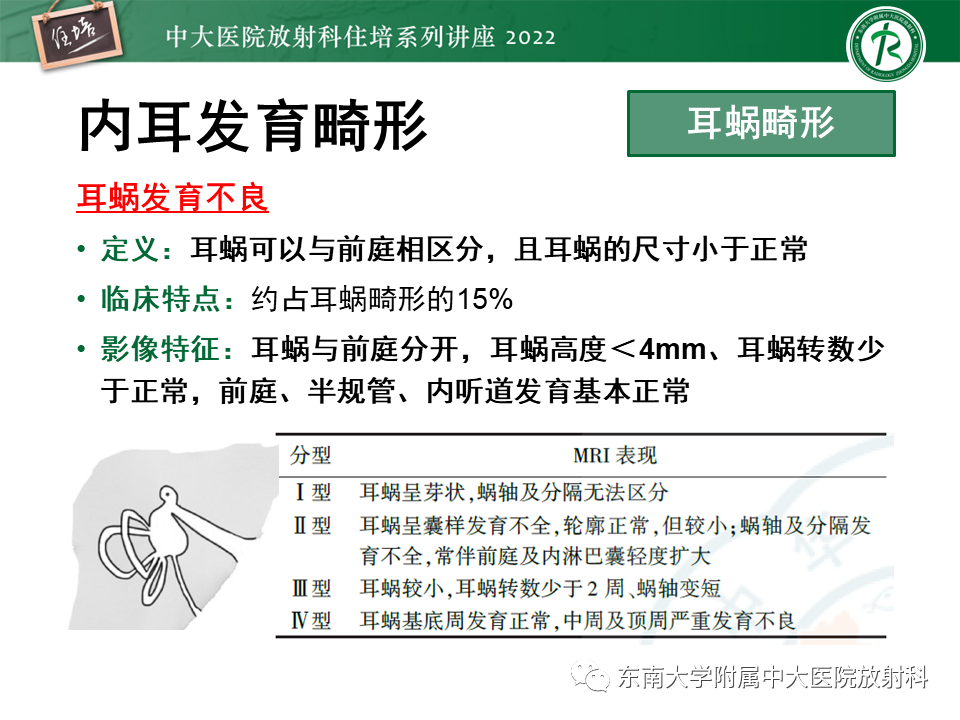 影像PPT - 【PPT】耳颞部发育异常影像评估-73