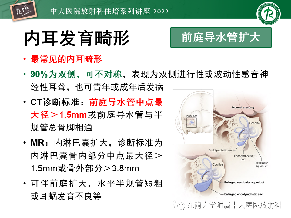 影像PPT - 【PPT】耳颞部发育异常影像评估-76