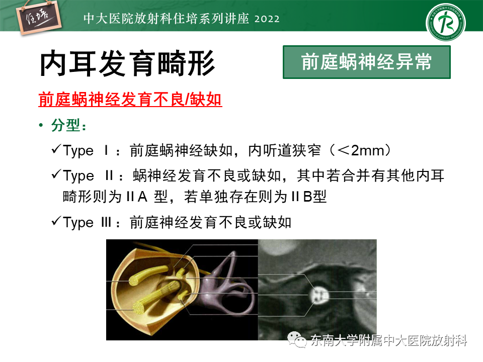 影像PPT - 【PPT】耳颞部发育异常影像评估-78