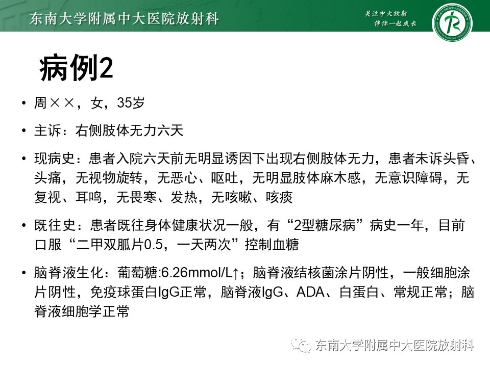 影像PPT - 【PPT】2022.07.08 神经系统疾病——脱髓鞘假瘤-44 影像PPT - 【PPT】2022.07.08 神经系统疾病——脱髓鞘假瘤-44