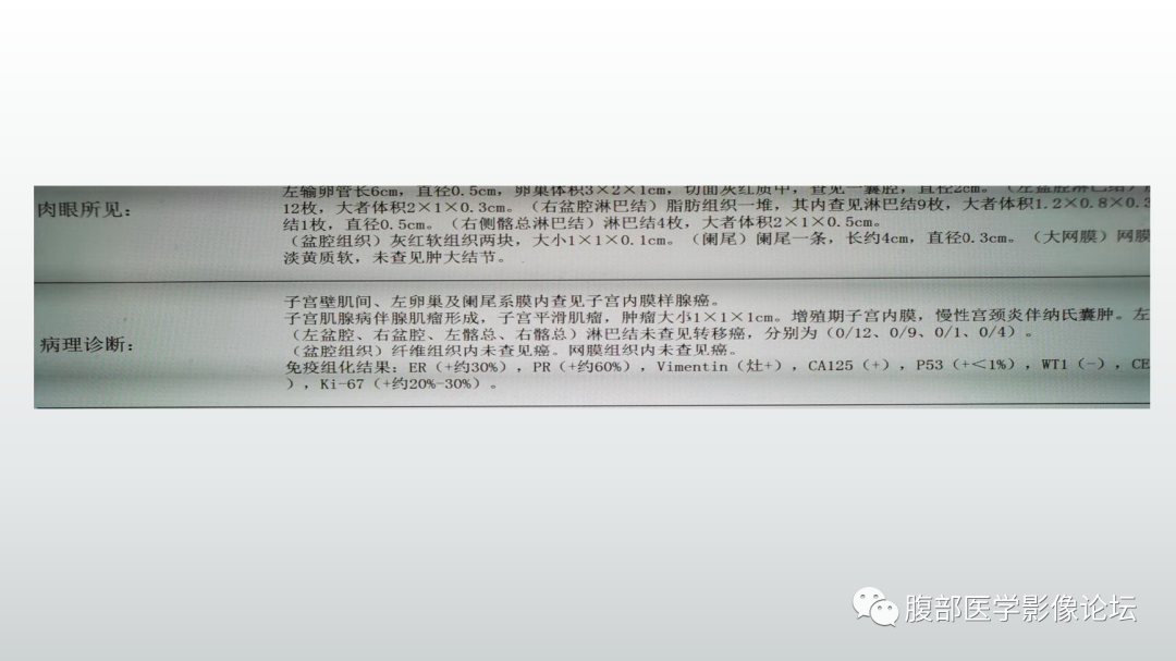 影像PPT - 【病例】子宫内膜样腺癌1例MR-11