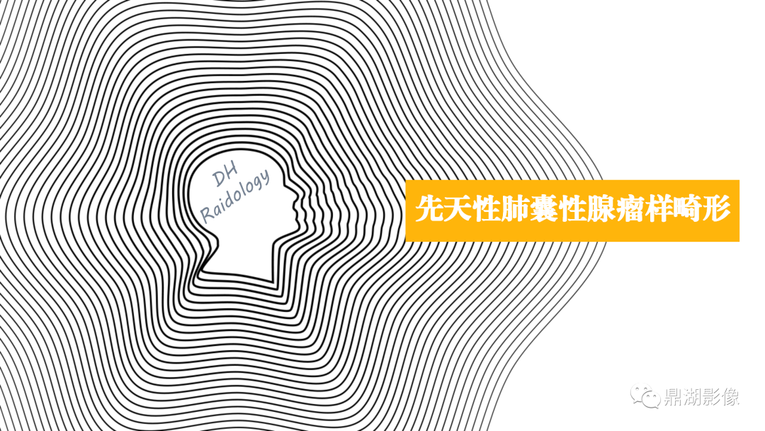 影像PPT - 【PPT】先天性肺囊性腺瘤样畸形-1