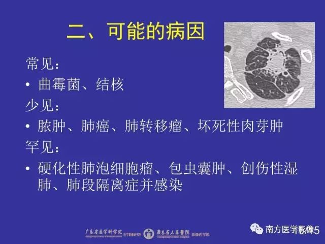 影像PPT - 【PPT】“空气新月征”的CT诊断和鉴别诊断-15