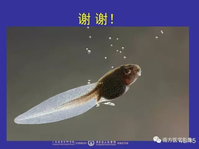 影像PPT - 【PPT】“空气新月征”的CT诊断和鉴别诊断-45