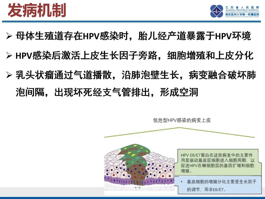 影像PPT - 【PPT】复发性呼吸道乳头状瘤病-19