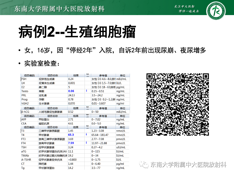 影像PPT - 【PPT】垂体柄病变的影像诊断-4