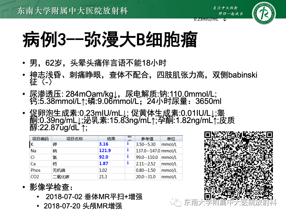 影像PPT - 【PPT】垂体柄病变的影像诊断-7
