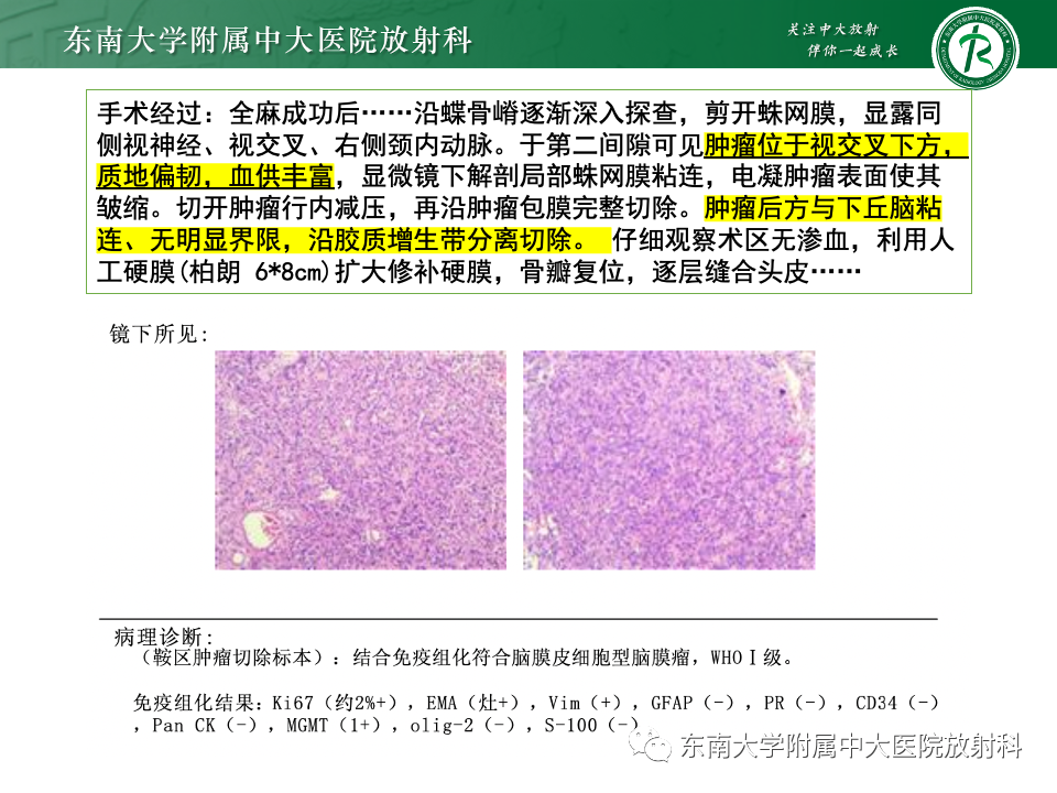 影像PPT - 【PPT】垂体柄病变的影像诊断-12