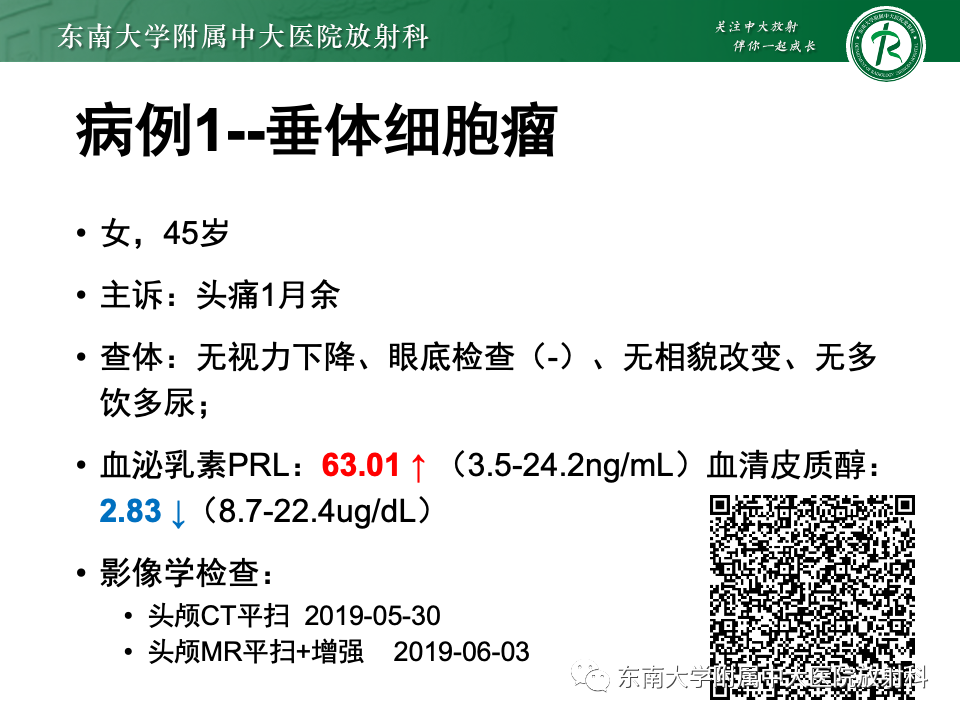 影像PPT - 【PPT】垂体柄病变的影像诊断-1