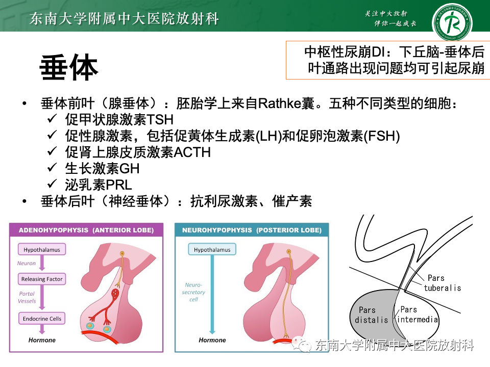 影像PPT - 【PPT】垂体柄病变的影像诊断-17