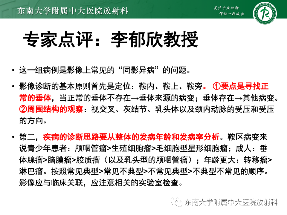 影像PPT - 【PPT】垂体柄病变的影像诊断-14