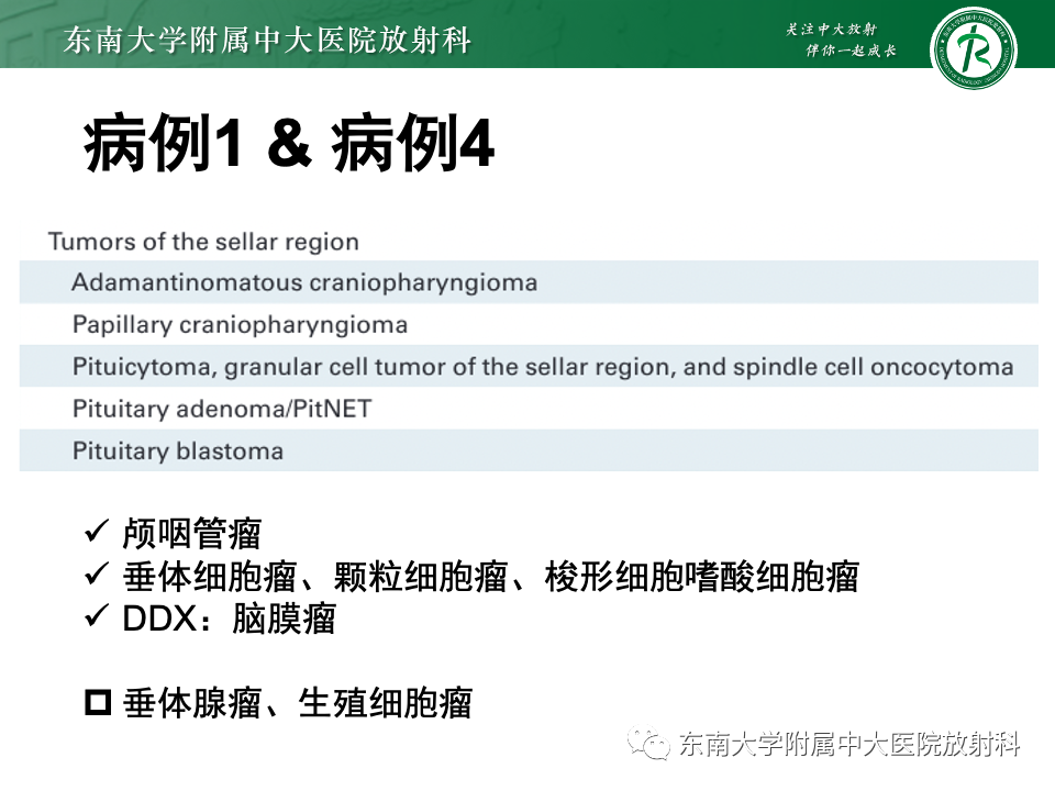 影像PPT - 【PPT】垂体柄病变的影像诊断-29