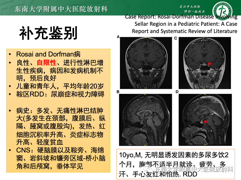 影像PPT - 【PPT】垂体柄病变的影像诊断-42