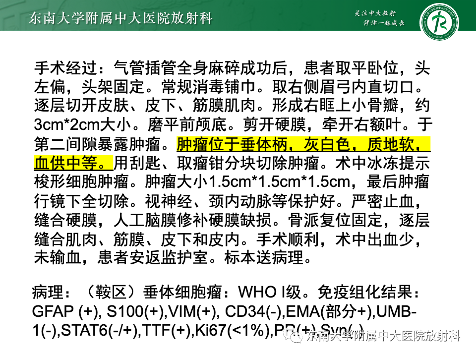 影像PPT - 【PPT】垂体柄病变的影像诊断-1
