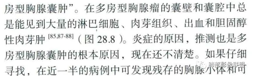 影像PPT - 【病例】年轻女性前纵隔囊变的胸腺瘤1例CT-59