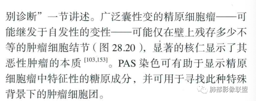 影像PPT - 【病例】年轻女性前纵隔囊变的胸腺瘤1例CT-70