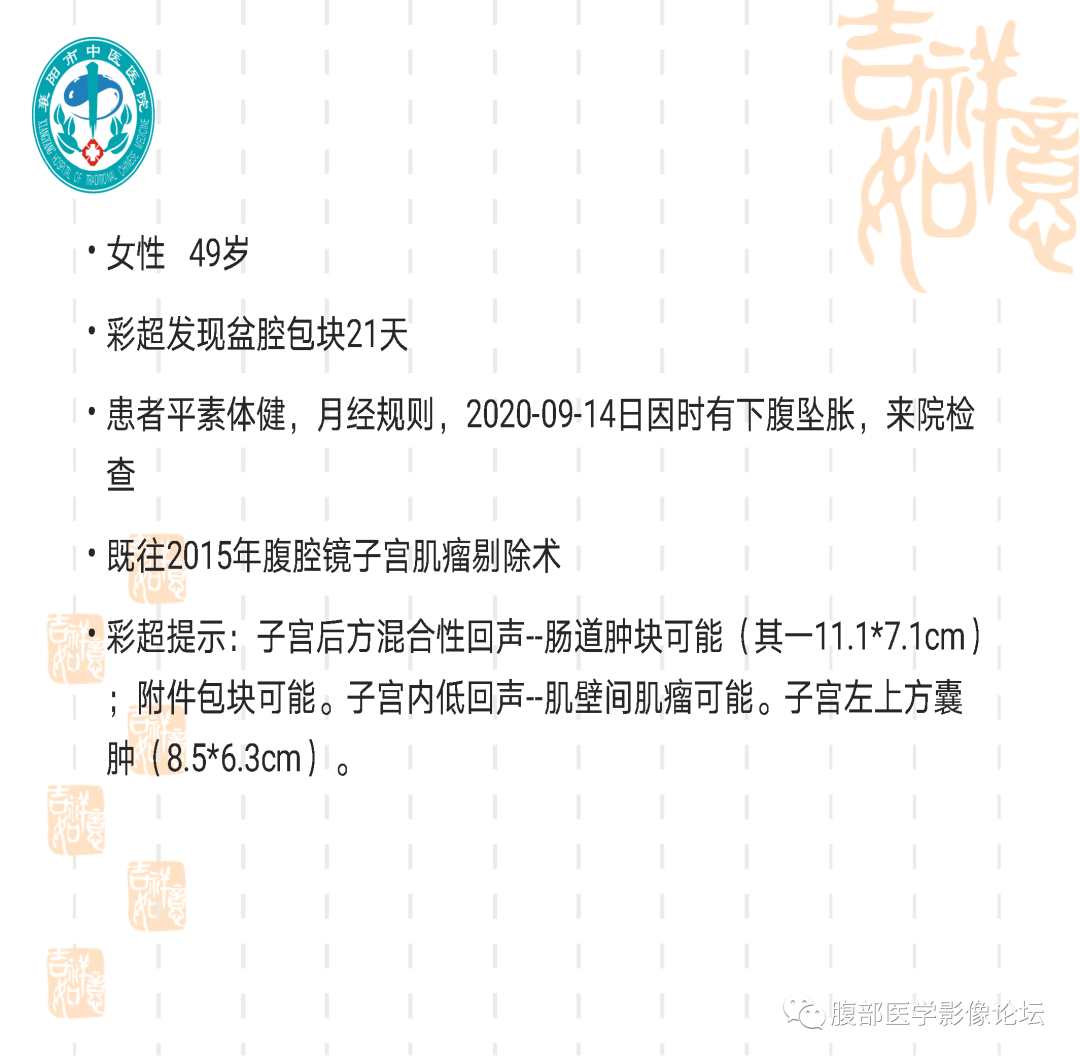 影像PPT - 【病例】子宫内膜间质肉瘤1例MR-2 影像PPT - 【病例】子宫内膜间质肉瘤1例MR-2