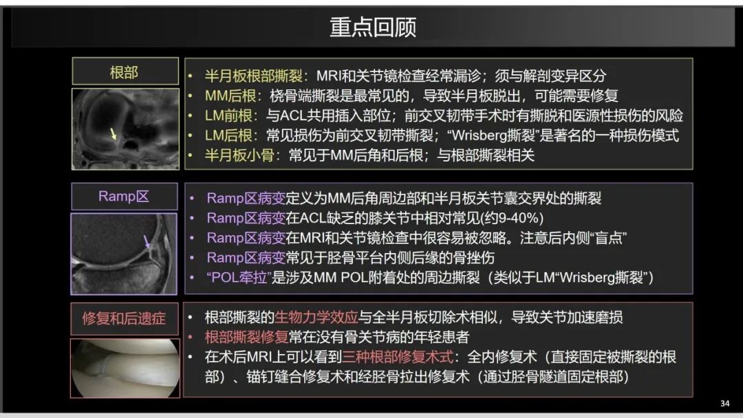 影像PPT - 【PPT】半月板根部,Ramp区,修复,及其后遗症-22 影像PPT - 【PPT】半月板根部,Ramp区,修复,及其后遗症-22