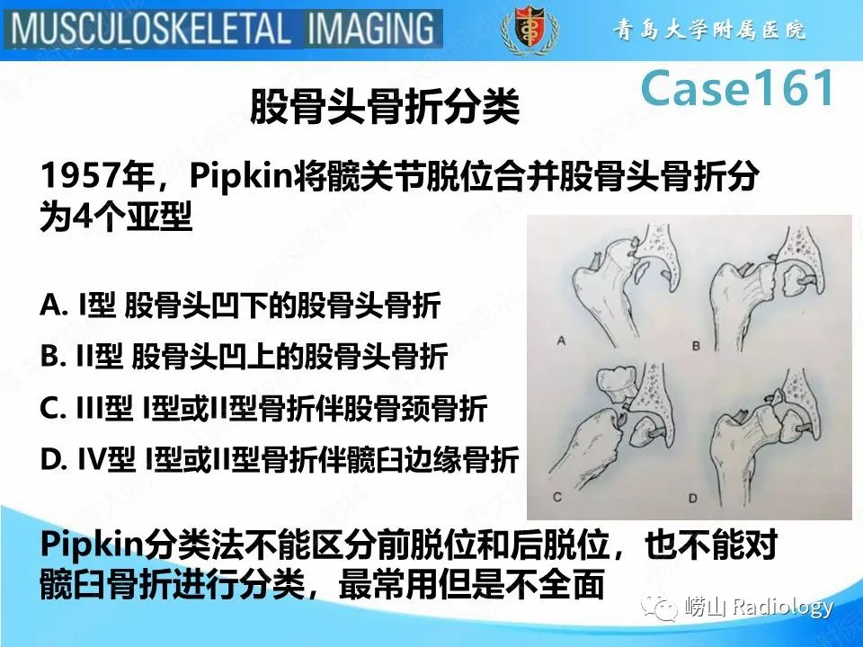 影像PPT - 【PPT】股骨头骨折-7