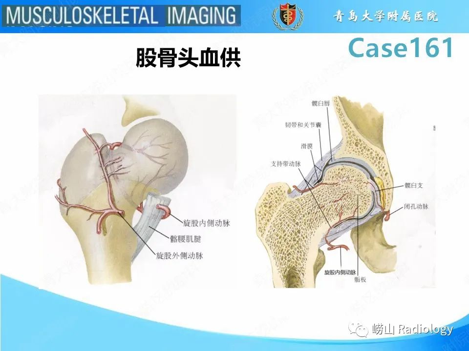 影像PPT - 【PPT】股骨头骨折-15