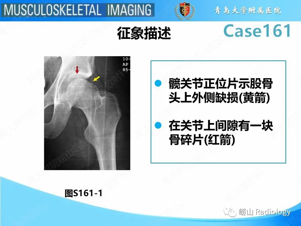 影像PPT - 【PPT】股骨头骨折-17