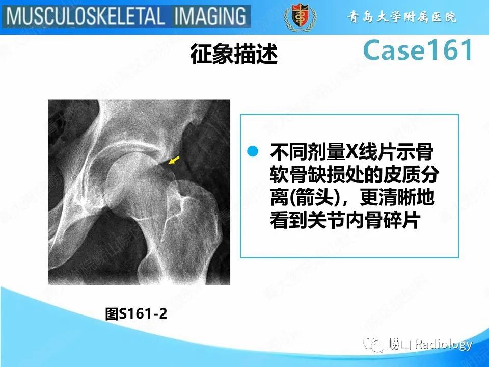 影像PPT - 【PPT】股骨头骨折-18