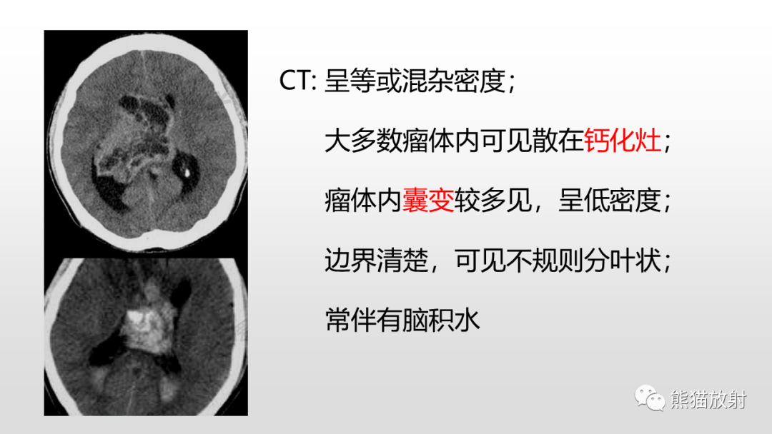 影像PPT - 【PPT】常见侧脑室占位的影像诊断-31