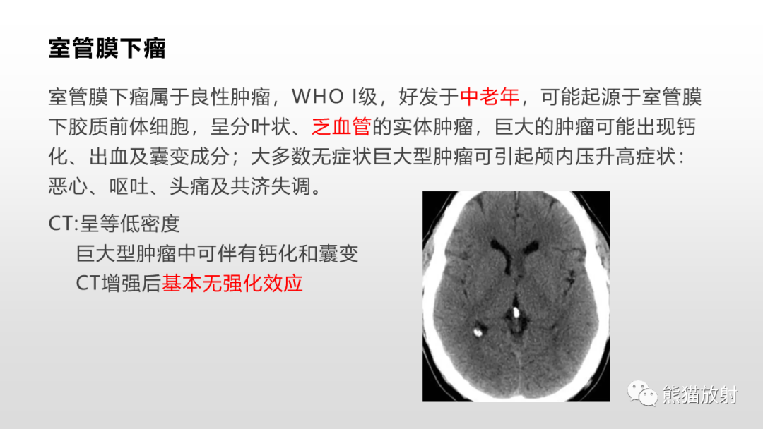 影像PPT - 【PPT】常见侧脑室占位的影像诊断-34