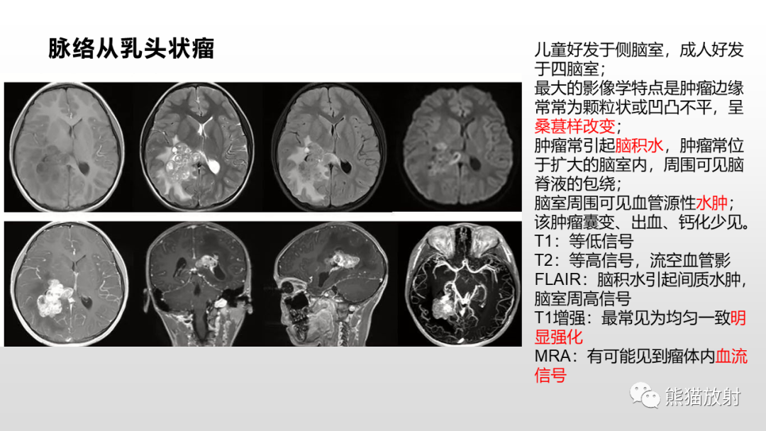 影像PPT - 【PPT】常见侧脑室占位的影像诊断-37