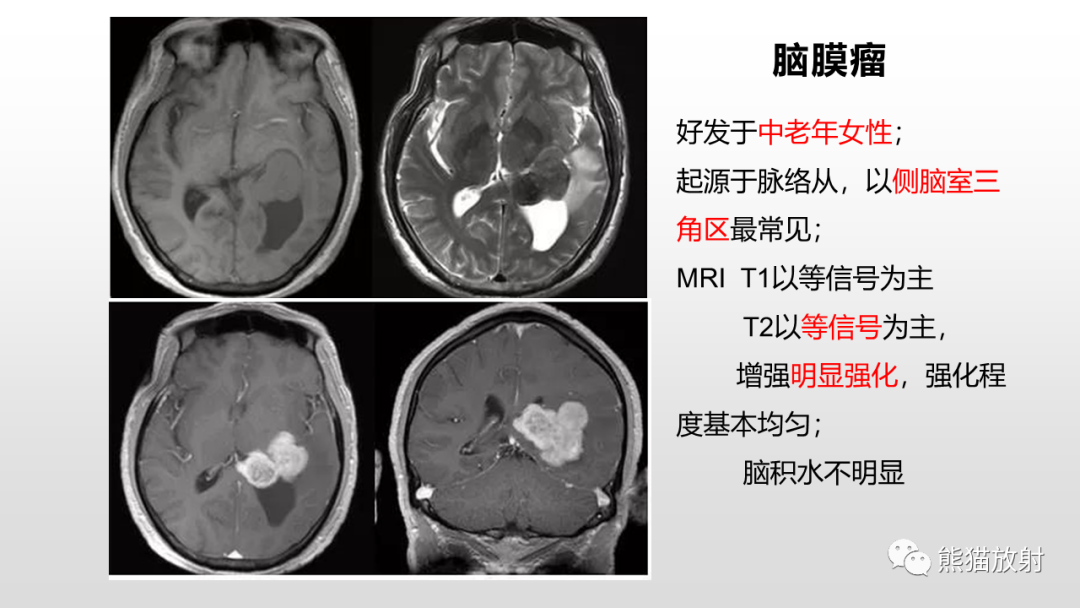 影像PPT - 【PPT】常见侧脑室占位的影像诊断-38
