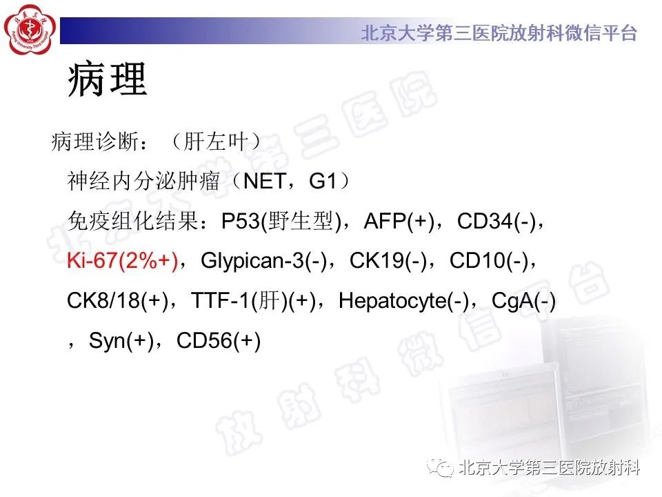 影像PPT - 【PPT】原发性肝脏神经内分泌肿瘤-7