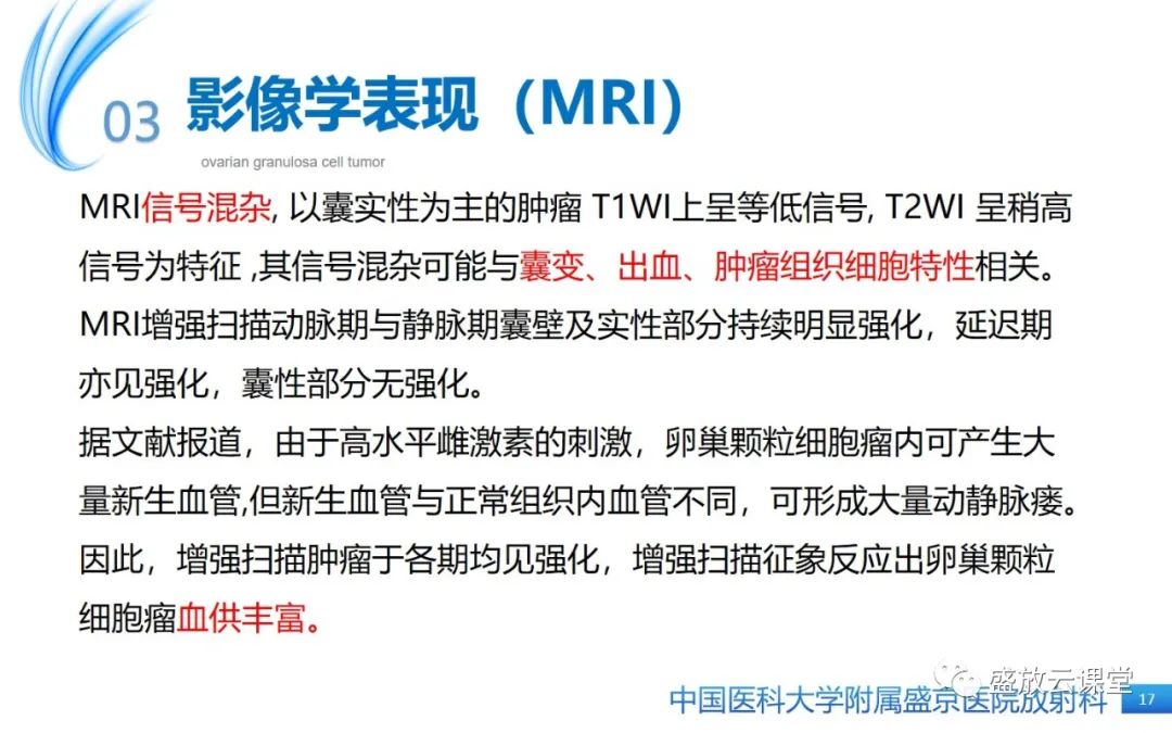影像PPT - 【PPT】卵巢颗粒细胞瘤-16