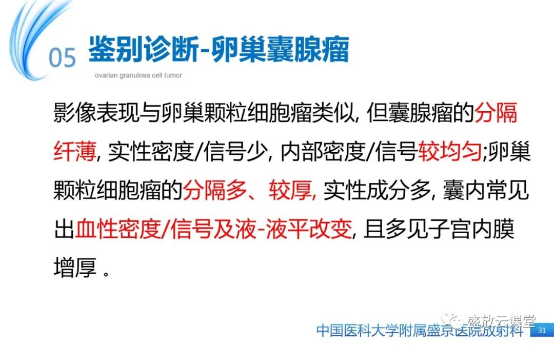 影像PPT - 【PPT】卵巢颗粒细胞瘤-30