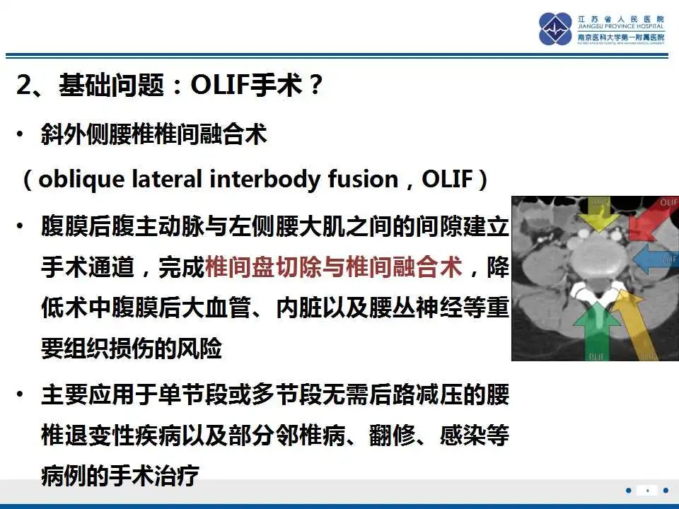 影像PPT - 【PPT】椎间融合器沉降-9