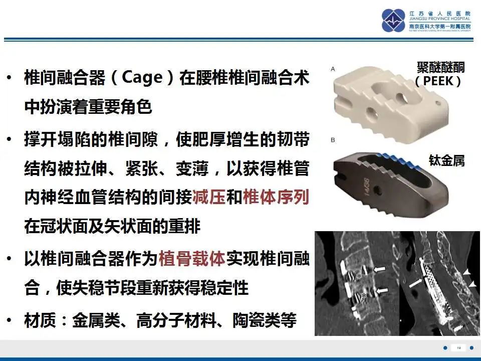 影像PPT - 【PPT】椎间融合器沉降-11