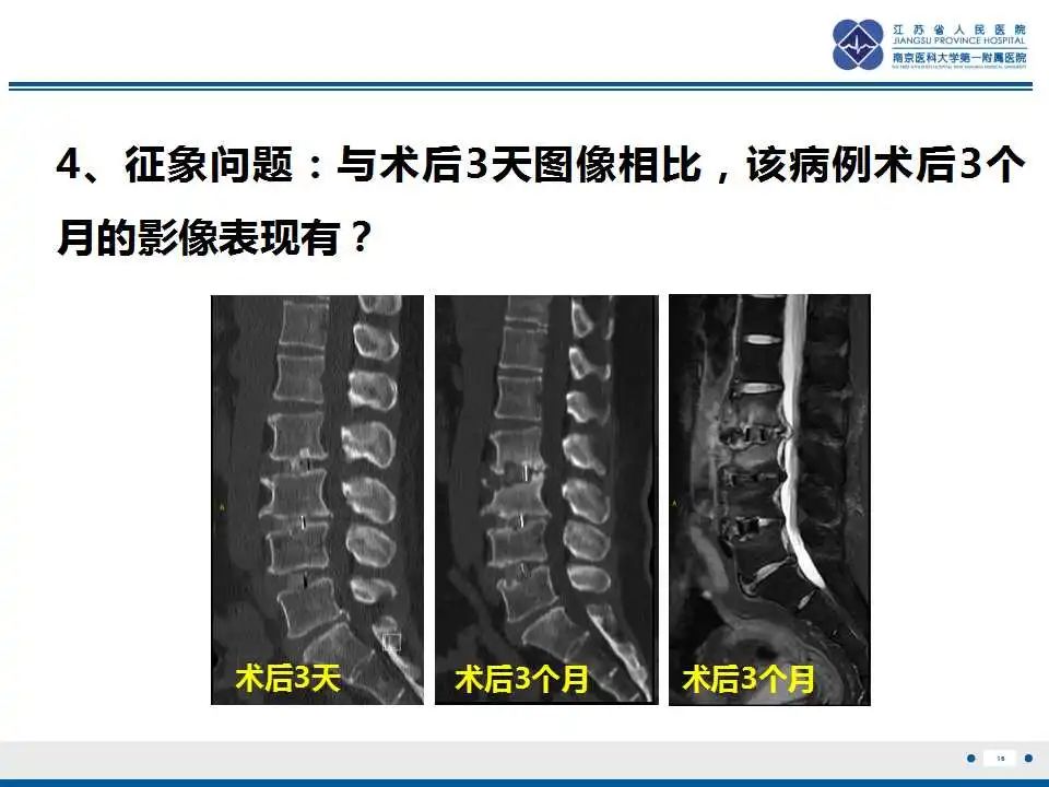 影像PPT - 【PPT】椎间融合器沉降-17