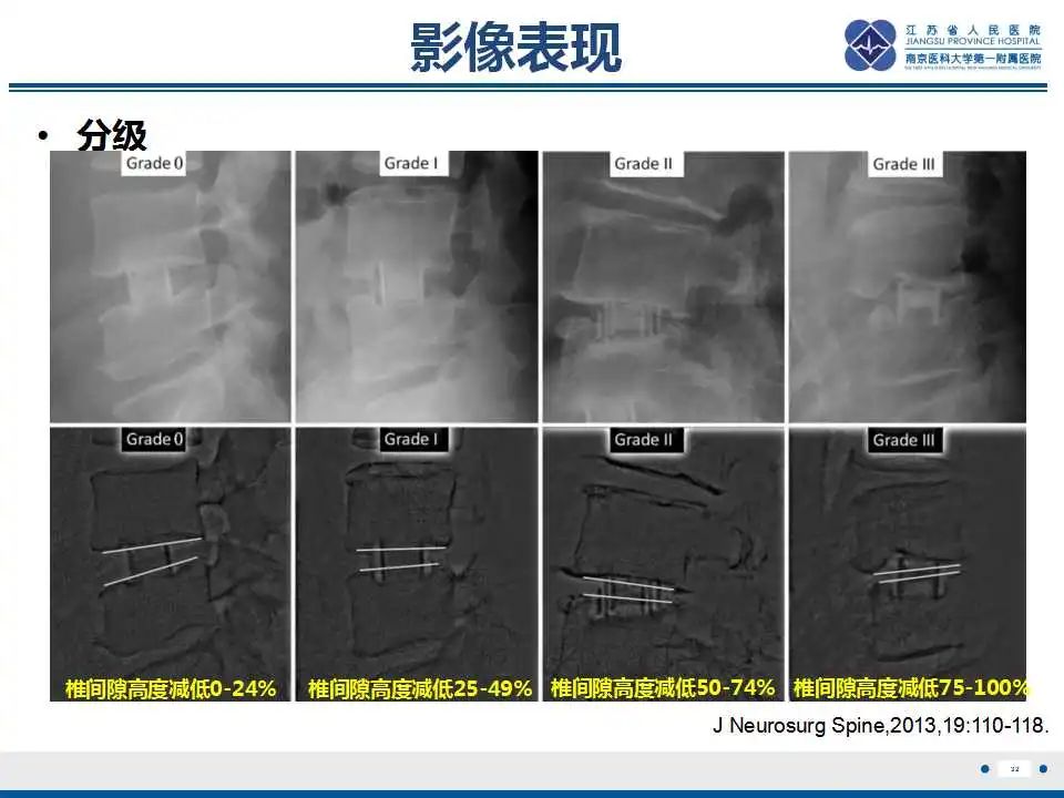 影像PPT - 【PPT】椎间融合器沉降-33