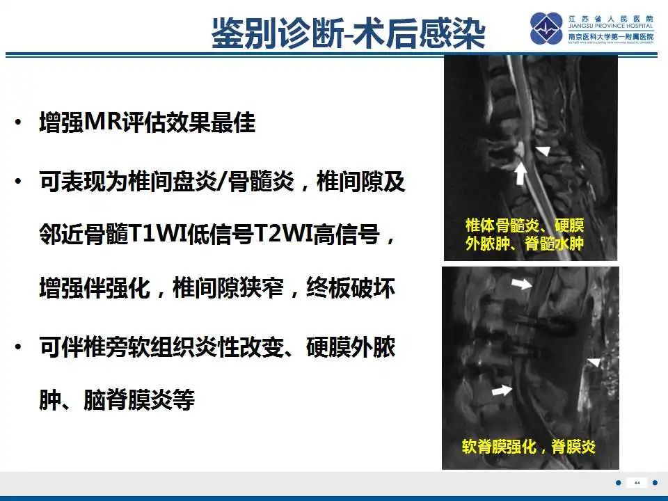 影像PPT - 【PPT】椎间融合器沉降-45