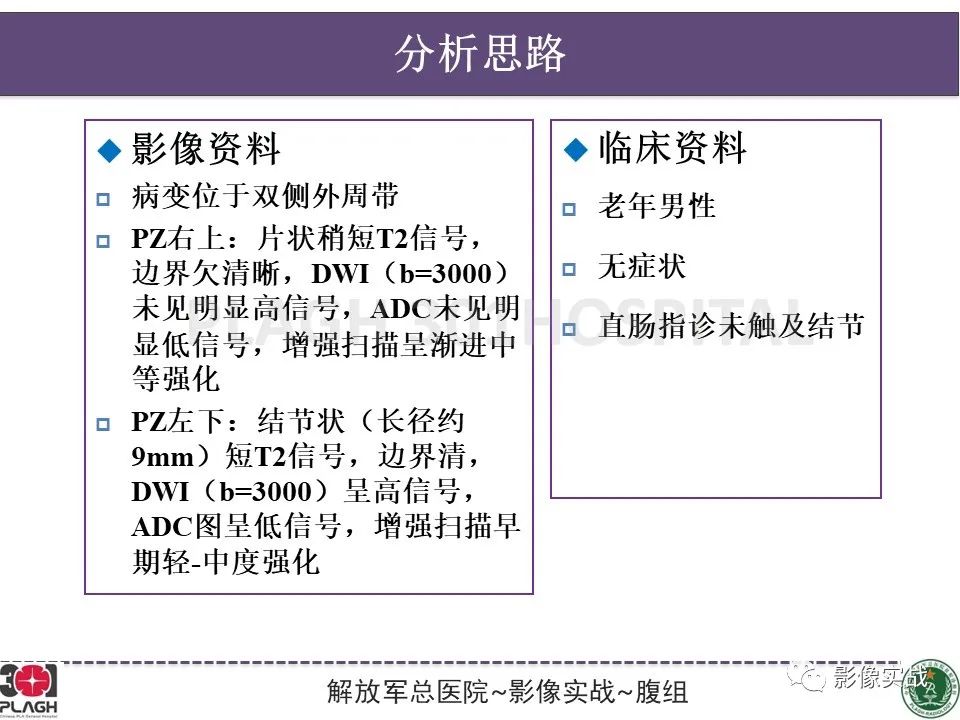 影像PPT - 【病例】前列腺癌PI-RADS评分1例MR-9
