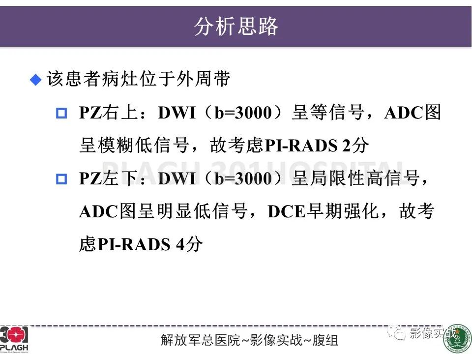 影像PPT - 【病例】前列腺癌PI-RADS评分1例MR-15