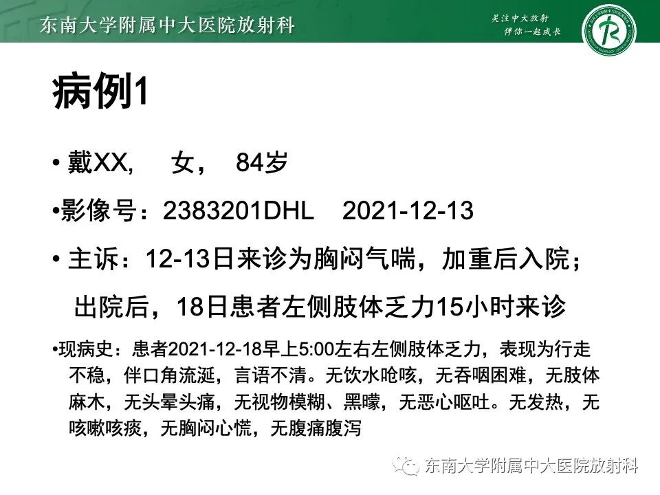 影像PPT - 【PPT】椎基底动脉延长扩张症-2