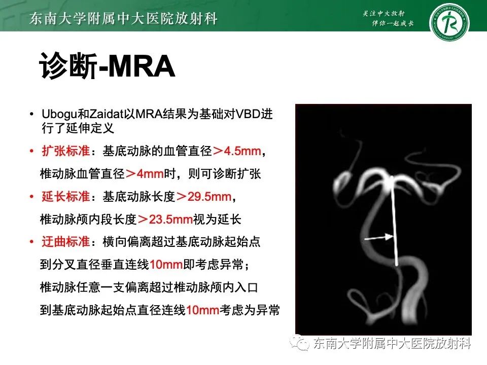 影像PPT - 【PPT】椎基底动脉延长扩张症-13