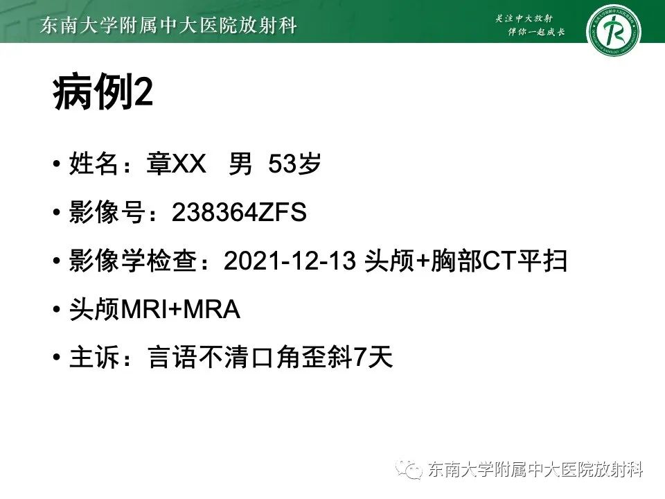 影像PPT - 【PPT】椎基底动脉延长扩张症-18