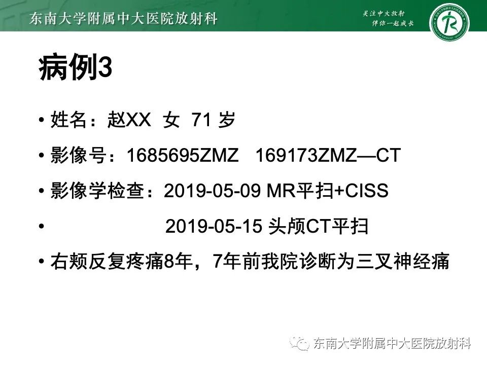 影像PPT - 【PPT】椎基底动脉延长扩张症-21