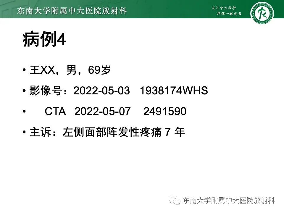 影像PPT - 【PPT】椎基底动脉延长扩张症-23
