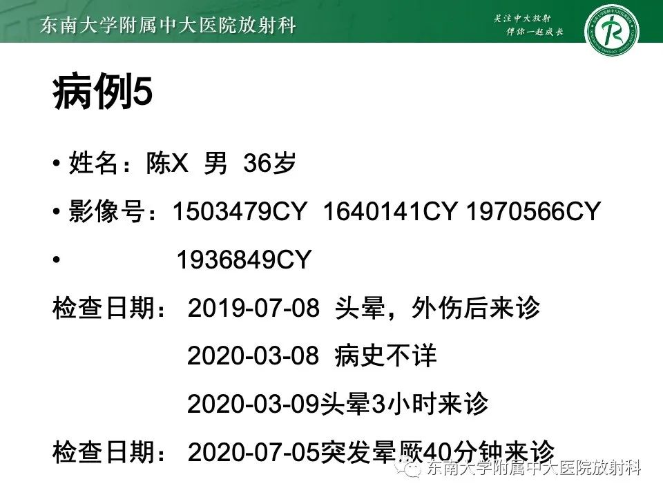 影像PPT - 【PPT】椎基底动脉延长扩张症-25