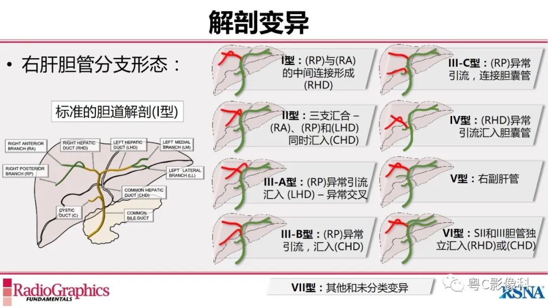 影像PPT - 【PPT】MRCP：放射医师必知-9