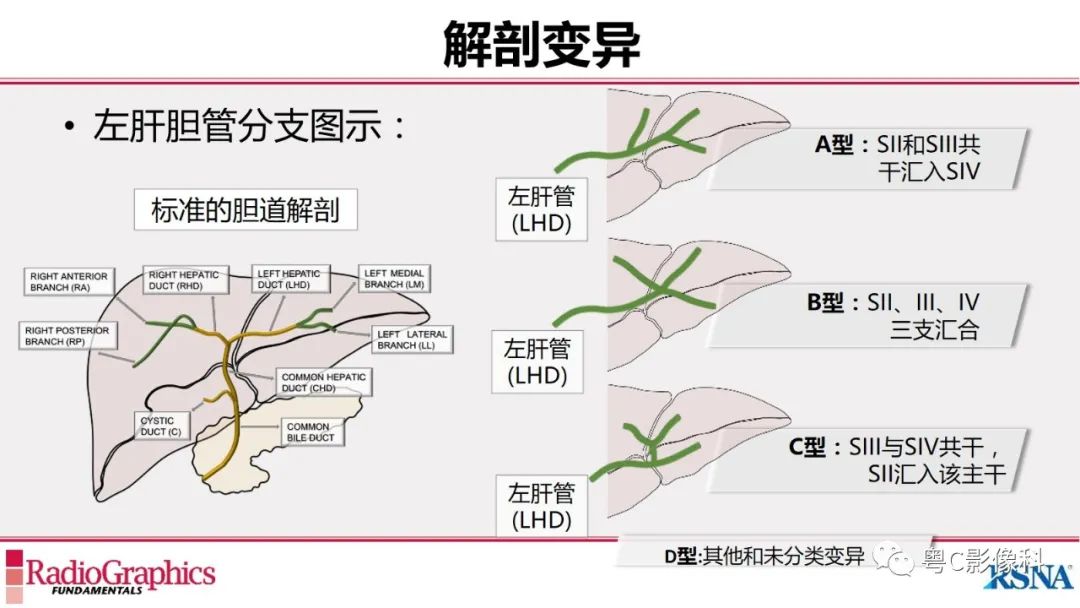 影像PPT - 【PPT】MRCP：放射医师必知-12