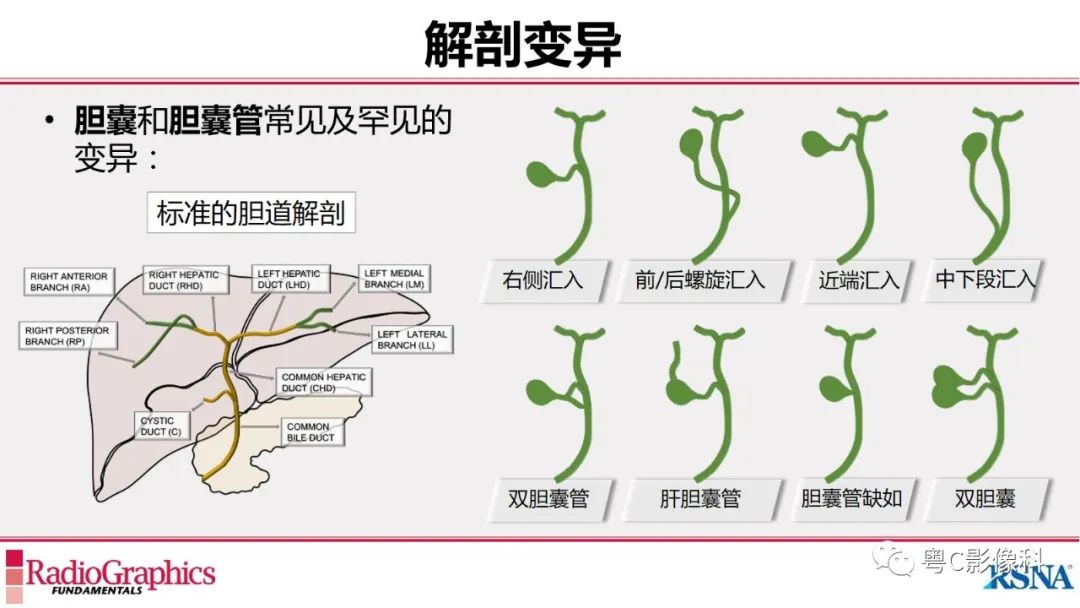 影像PPT - 【PPT】MRCP：放射医师必知-13
