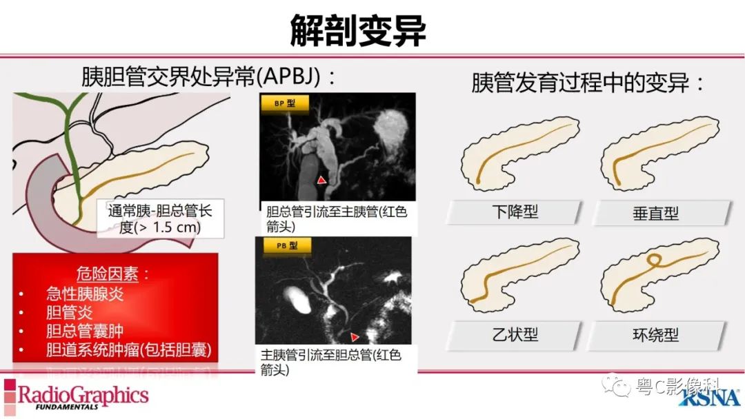 影像PPT - 【PPT】MRCP：放射医师必知-16
